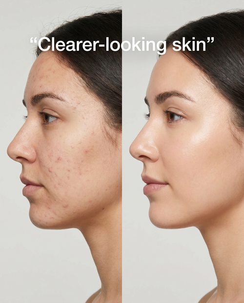 BloomieNest Éclat LED Therapy Mask