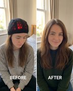 Bloomienest Luminara Hair Regrowth Crown